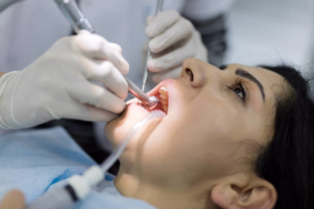 Root Canal Treatment at Dental Associates of NJ in Bayonne