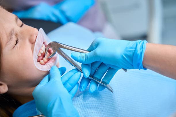 Tooth extractions at Dental Associates in Bayonne